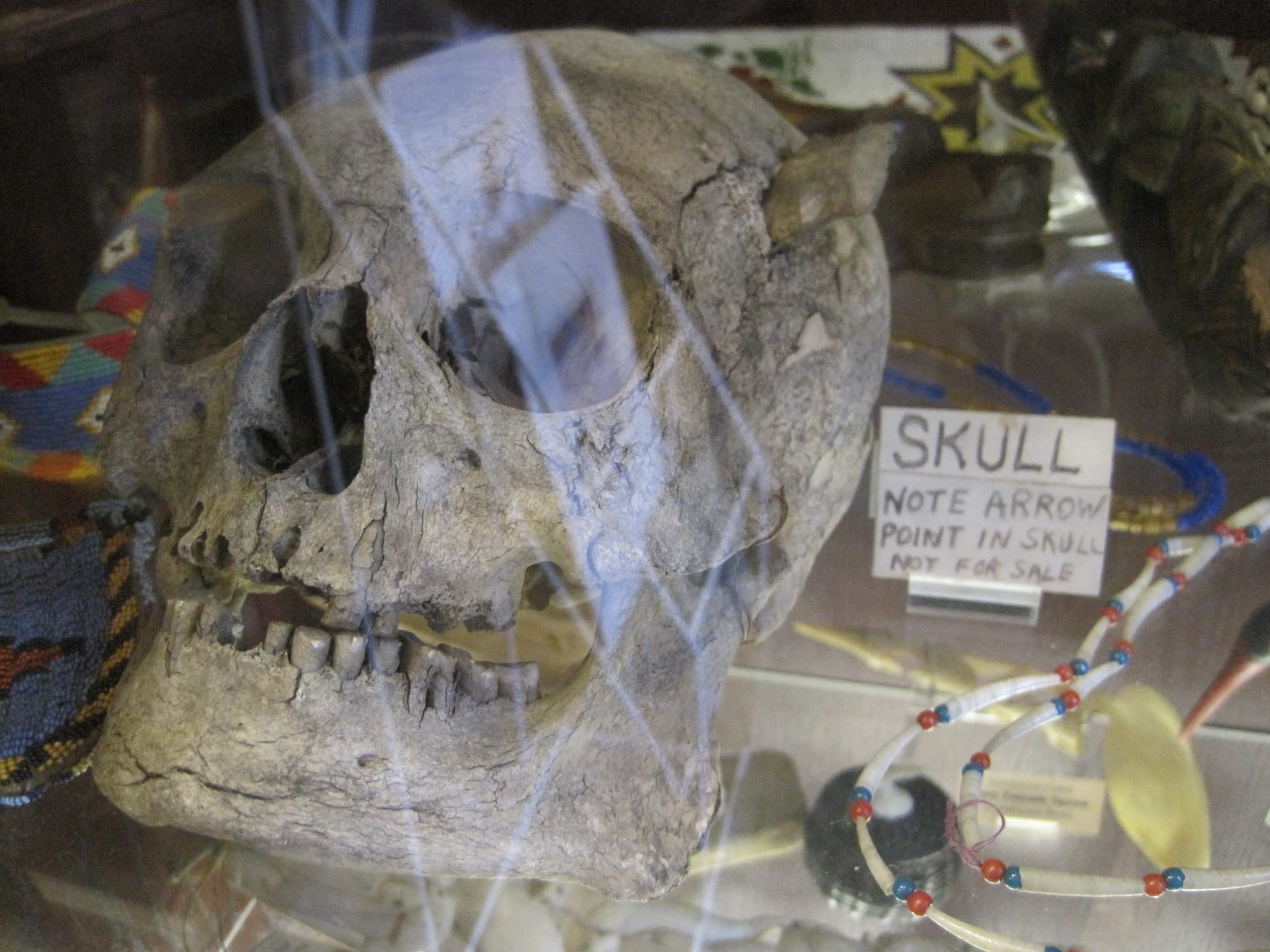 Note: Arrow point in skull.