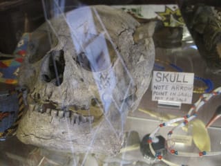 Note: Arrow point in skull.